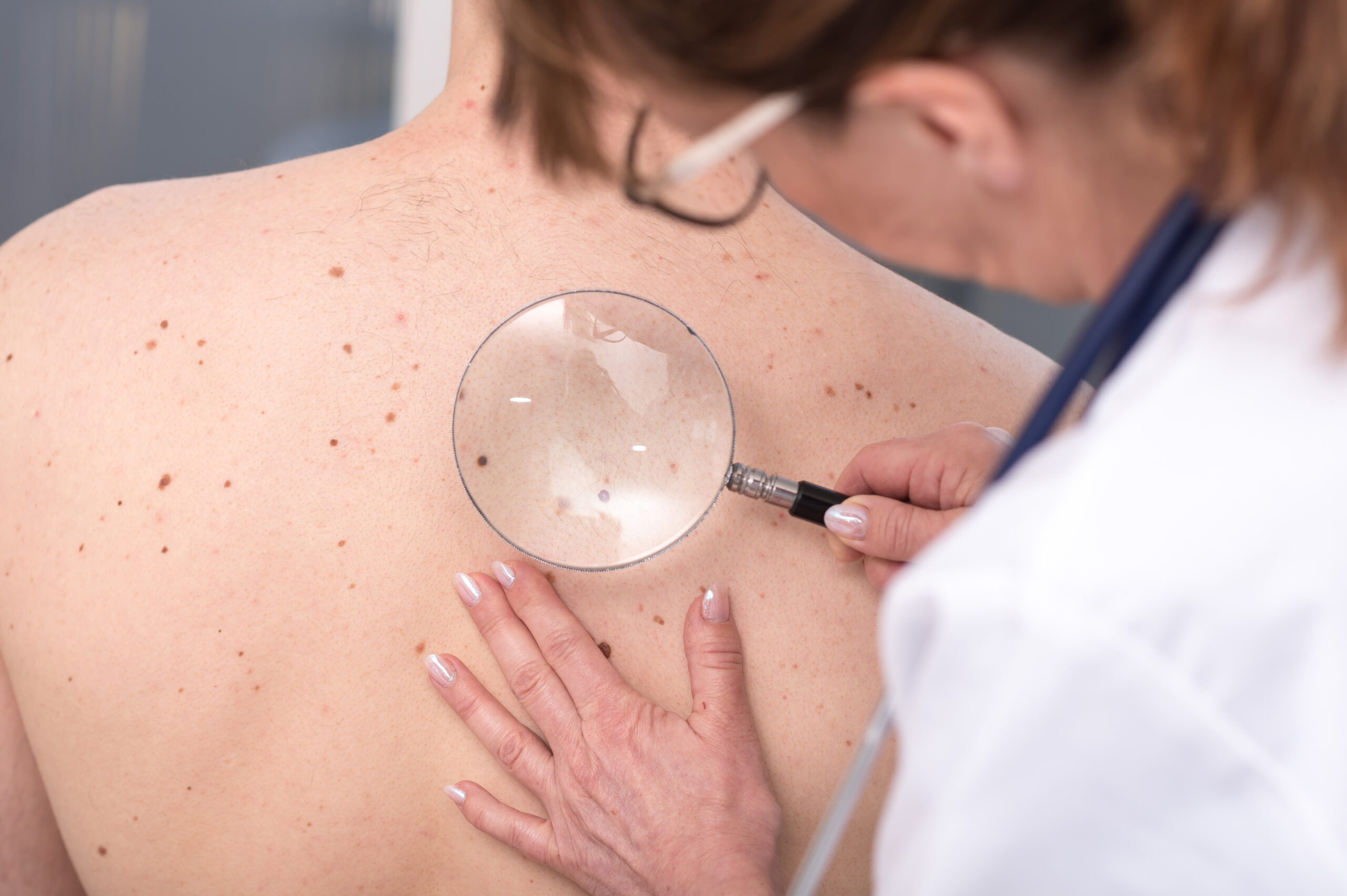 Dermatologist examining the skin of a patient About Flexile Classic