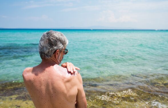 What Areas of the Body Are Most Prone to Skin Cancer?