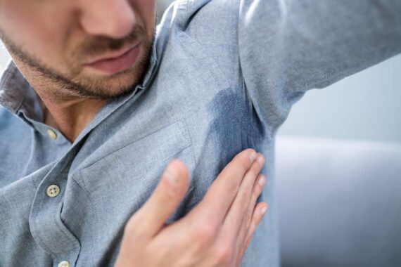 I Have Hyperhidrosis. What Do I Do?