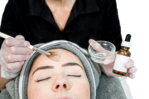 Is a Chemical Peel Safe for Sensitive Skin?