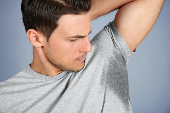 5 Ways to Handle Hyperhidrosis in the Winter