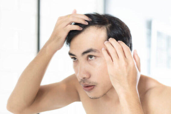 Buyer Beware: How to Spot Scam Hair Loss Products