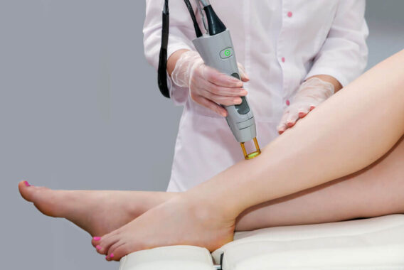 Laser Hair Removal: Show Off Your Smoothest Skin Ever