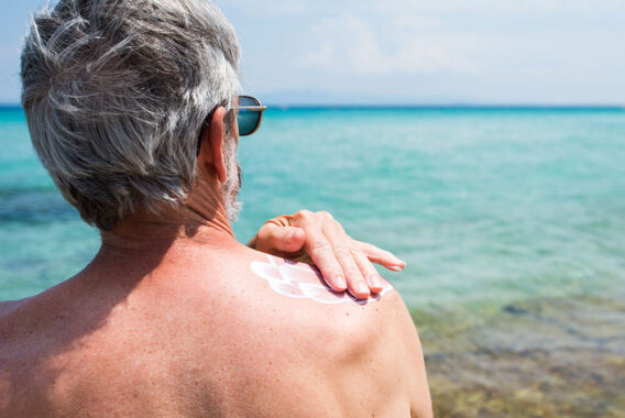 Skin Cancer Awareness Month: 5 Best Tips for Protecting Yourself