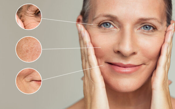 You Can Have Fewer Wrinkles: Ask Your Dermatologist About Skin Therapies