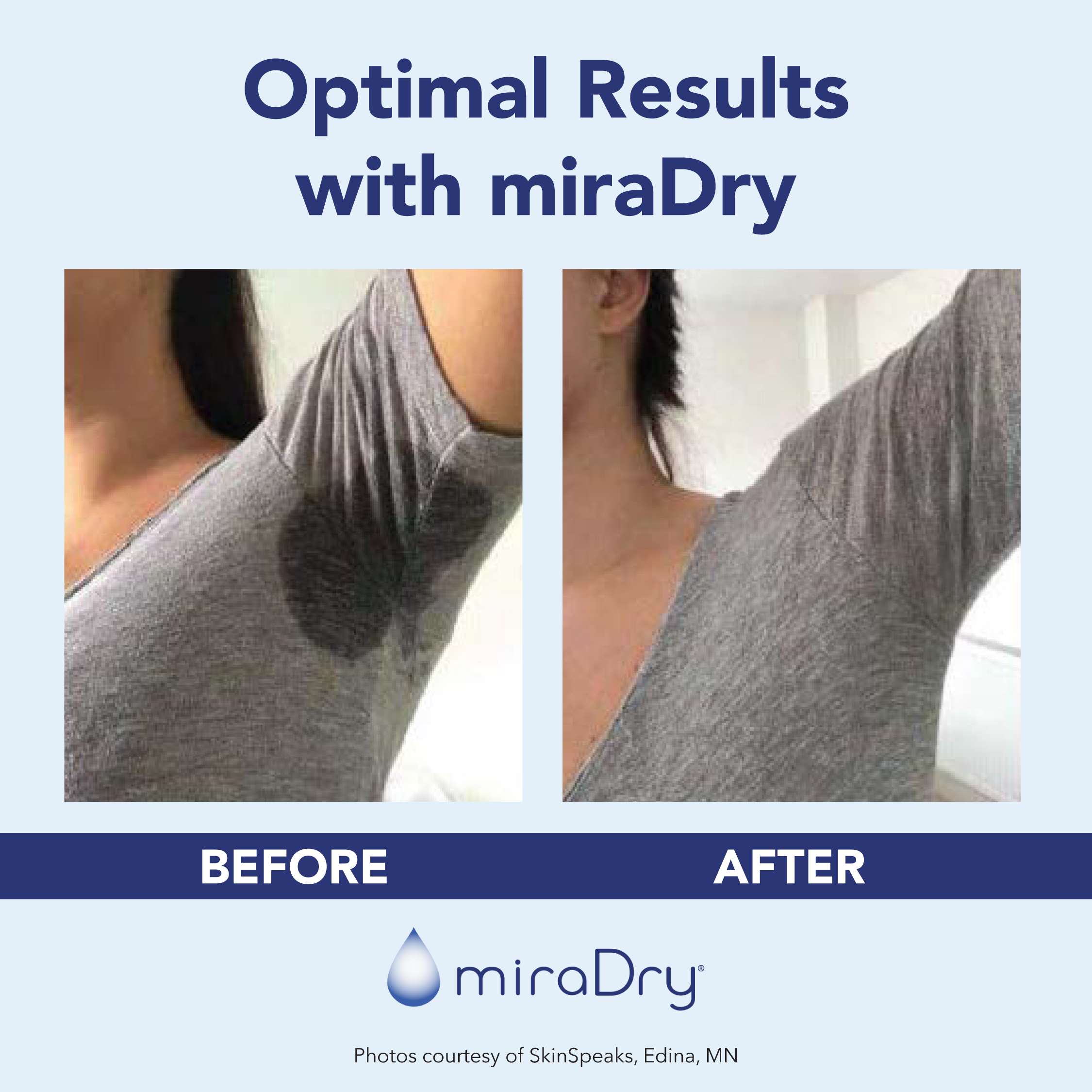 Services Derm of Cape Cod