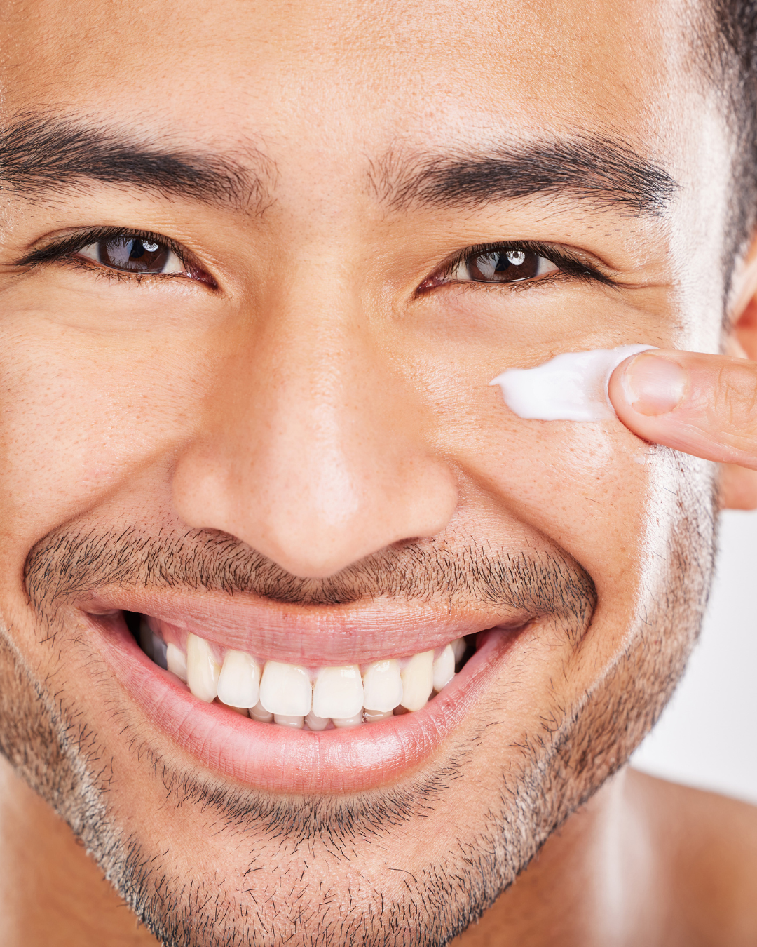 Men’s Acne Treatment: Causes, Prevention & Dermatologist Tips for Clearer Skin