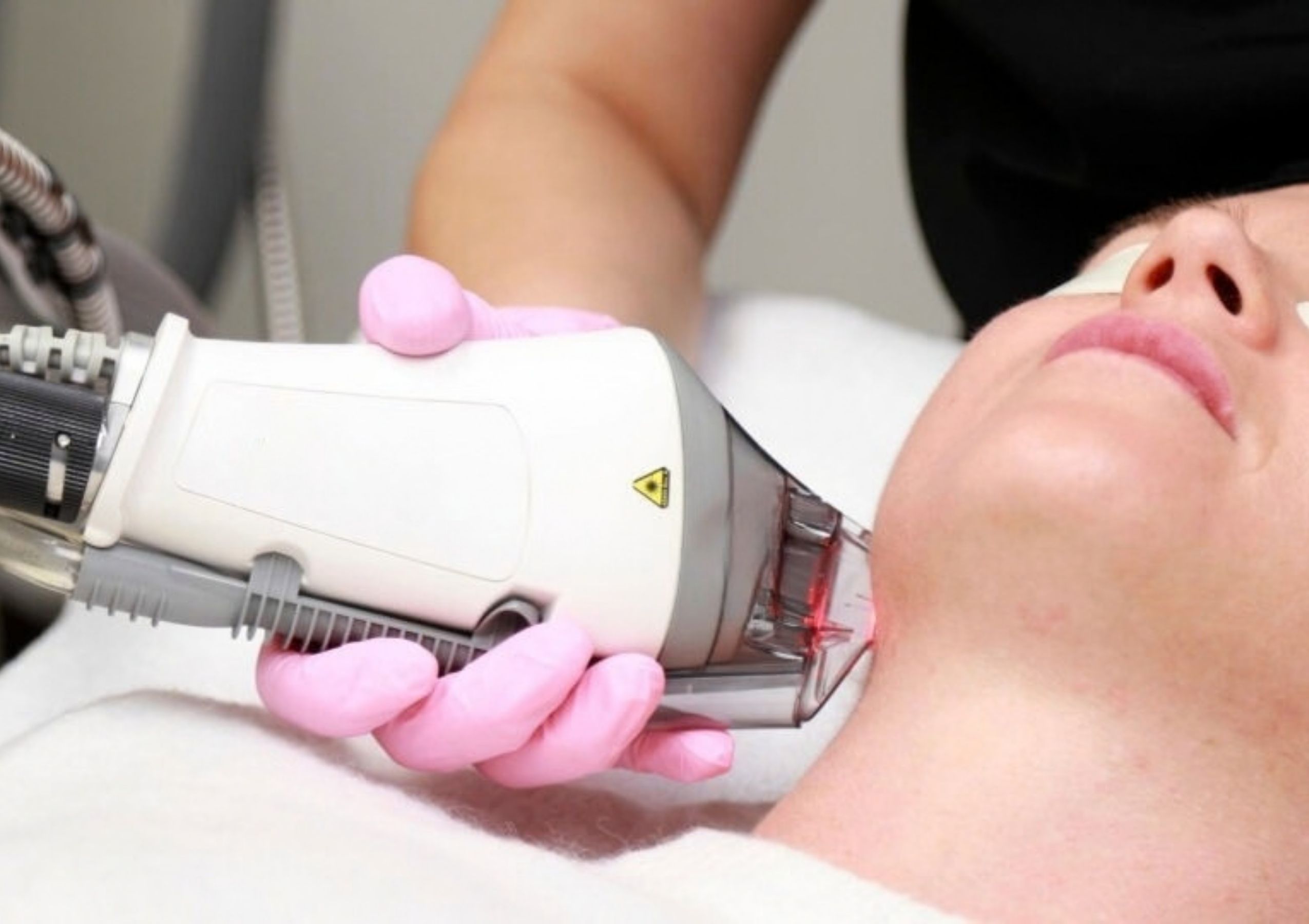 Clinician in gloves uses a handheld cosmetic laser on a woman's cheek during a facial treatment.